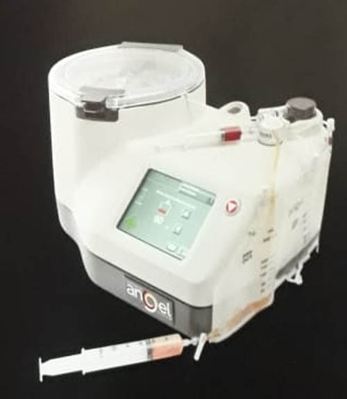 tratamiento intraarticular de la artrosis